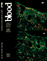 Cationic peptides from leukocytes might kill bacteria by activating their autolytic enzymes causing bacteriolysis: why are publications proposing this concept never acknowledged?