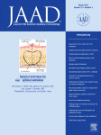 A psychometric study of patients with nail dystrophies