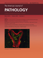 Endothelial cell killing by neutrophils. Synergistic interaction of oxygen products and proteases.