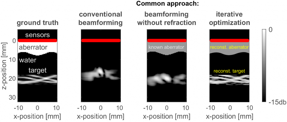 photoacoustic_imaging_results