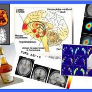 Gadi Goelman, and Evan Morris, Assoc. Prof. of Radiology, Yale University, co-teaching, a mini course on Imaging Drugs in the Brain with PET (Positron Emission Tomography)
