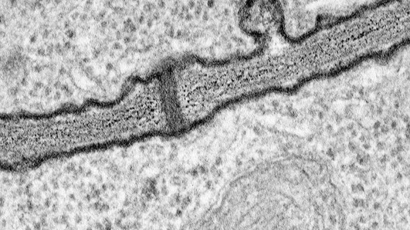 Plasmodesmata in callus cells