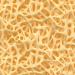 | The influence of cannabinoids on hematological reconstitution and on graft versus host disease after Bone Marrow Transplantation in murine model.