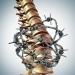| Cannabis and Acute Neuropathic Pain