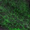 Plasmodesmata in callus cells PDLP5-GFP